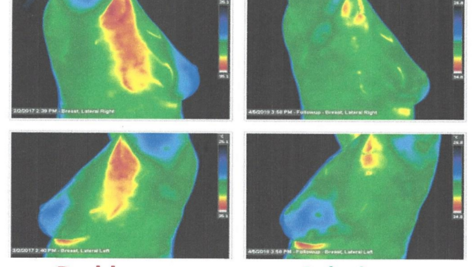 Dirty Little Secret on Underarm Health